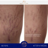 Крем для тела на основе TFC8® 200 мл