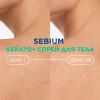 Sebium Kerato+ Cпрей для тела против несовершенств