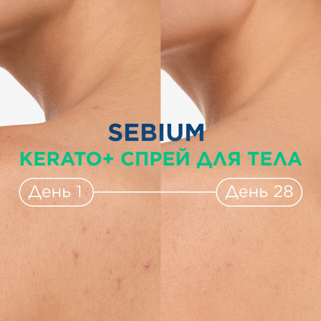 Sebium Kerato+ Cпрей для тела против несовершенств - изображение 4