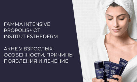 Акне у взрослых: особенности, причины появления и лечение.