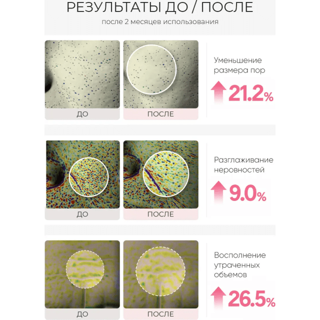 Антивозрастной тонер-эссенция с ретиналем и микроиглами - изображение 3