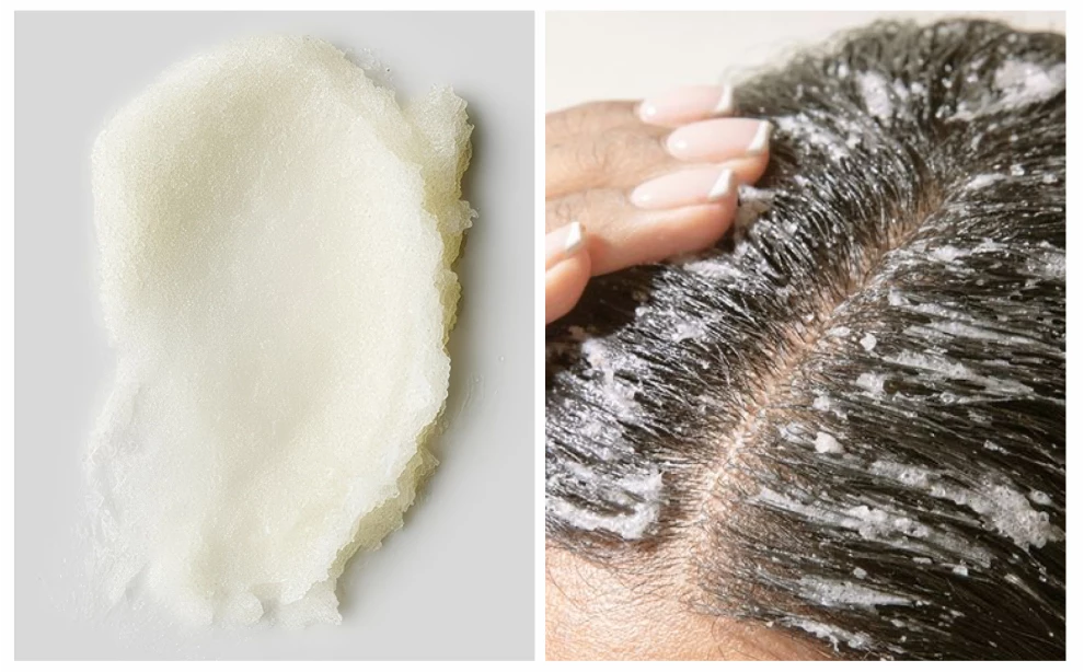 Скраб для кожи головы в домашних условиях: зачем нужен и какой лучше выбрать