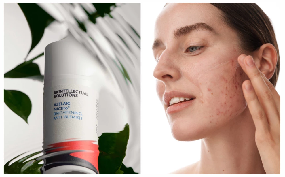 Азелаиновая кислота для лица: что это, эффект и как использовать