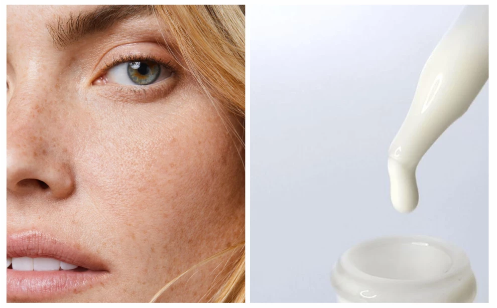 Азелаиновая кислота для лица: что это, эффект и как использовать