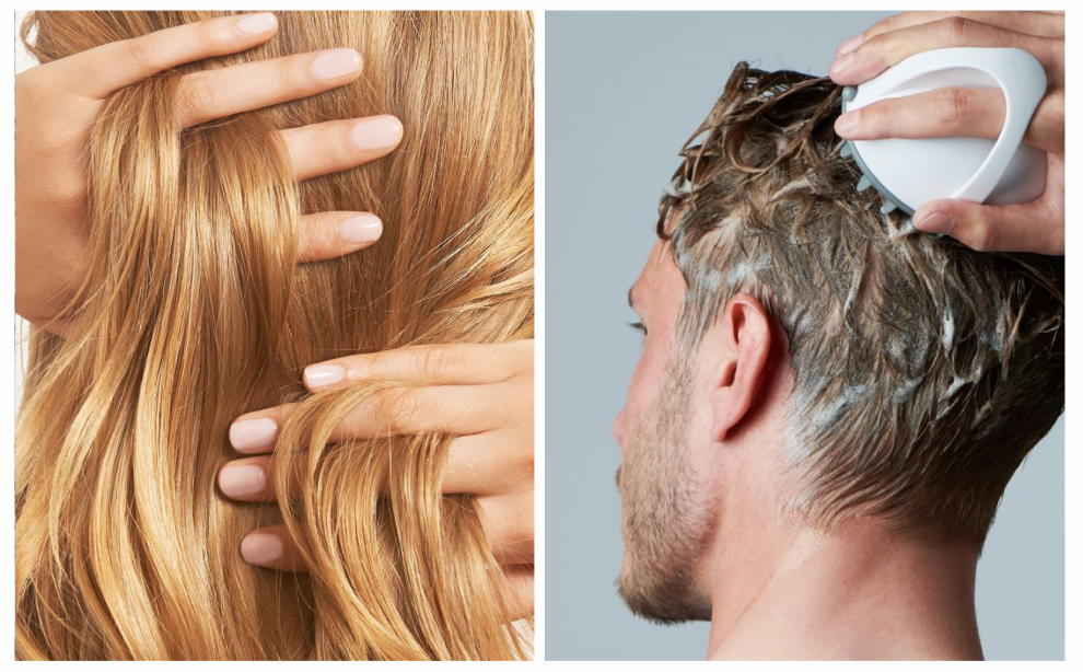 Выпадение волос: причины у мужчин и женщин, лечение, эффективное средство от выпадения