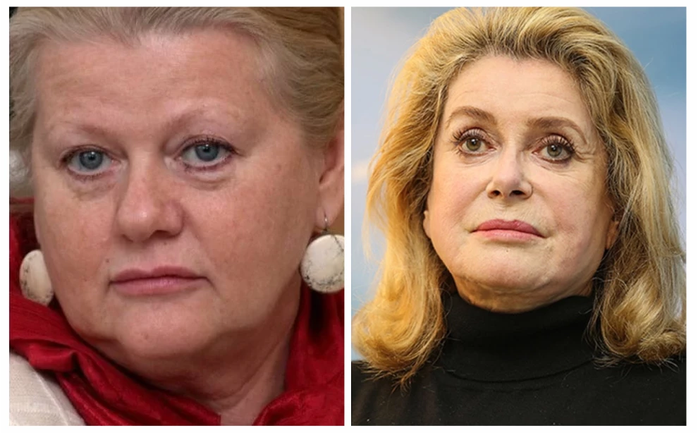 деформационный тип старения, отечно-деформационный