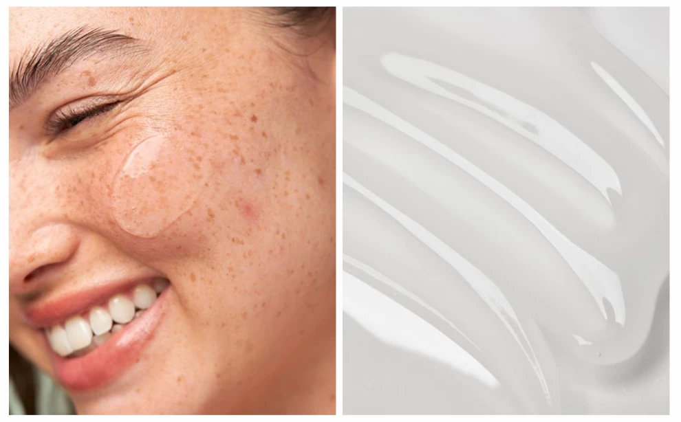 Азелаиновая кислота для лица: что это, эффект и как использовать