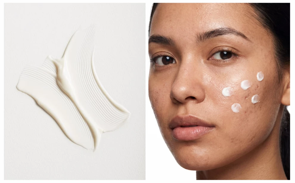 Азелаиновая кислота для лица: что это, эффект и как использовать