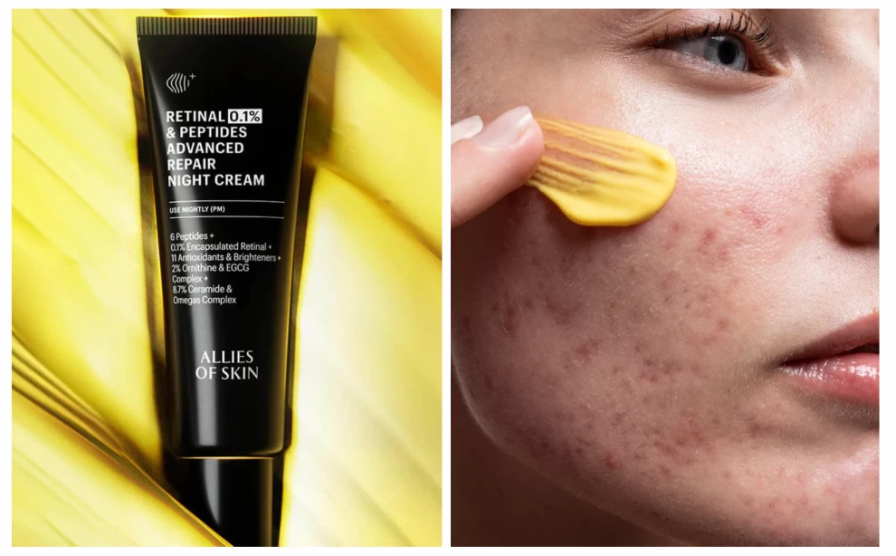 Всё о ретинале: чем отличается от ретинола и как использовать правильно