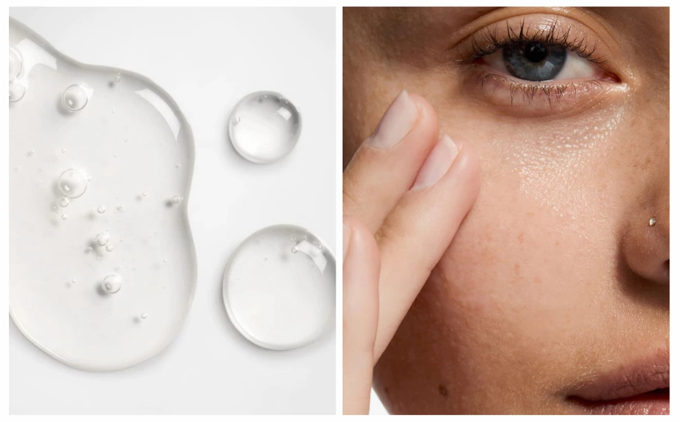 Как избавиться от высыпаний: правильный уход за проблемной кожей. Лучшие средства для очищения, увлажнения и коррекции акне.