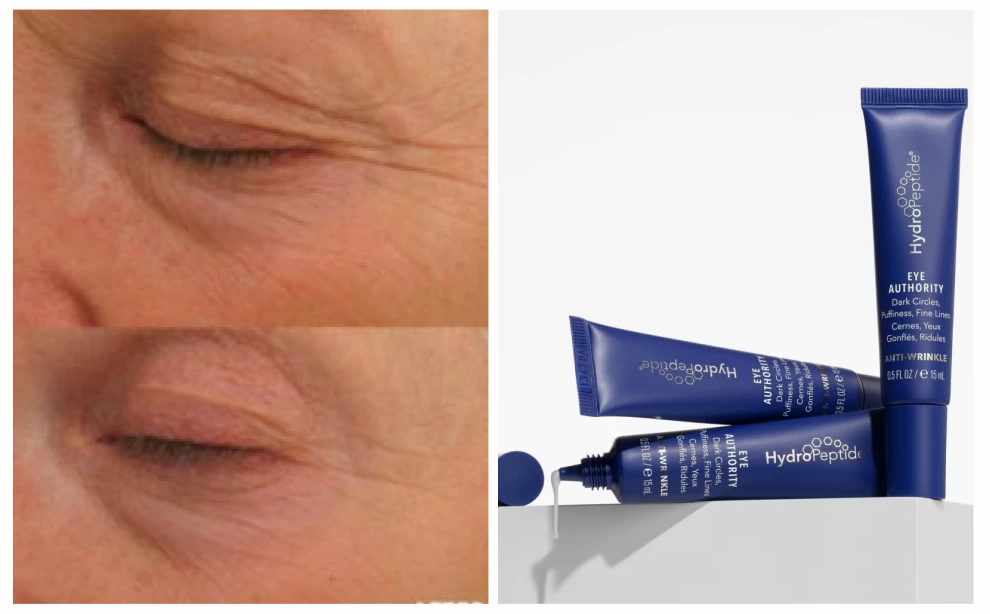 Кремы для кожи вокруг глаз 40+: рейтинг лучших