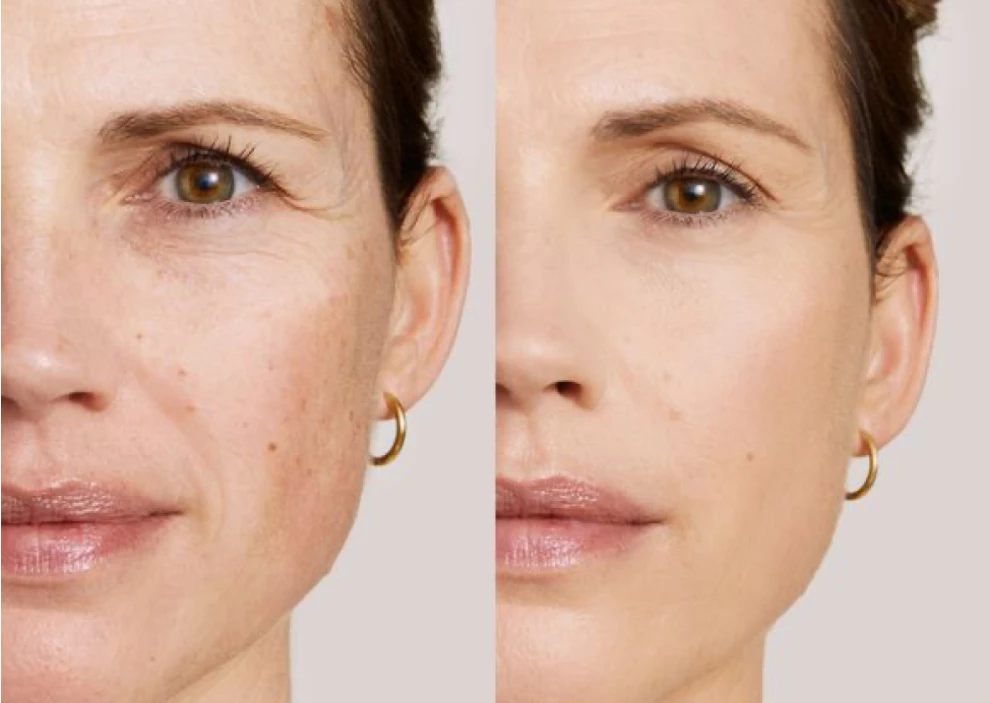 Тональный крем для возрастной кожи лица: рейтинг лучших средств