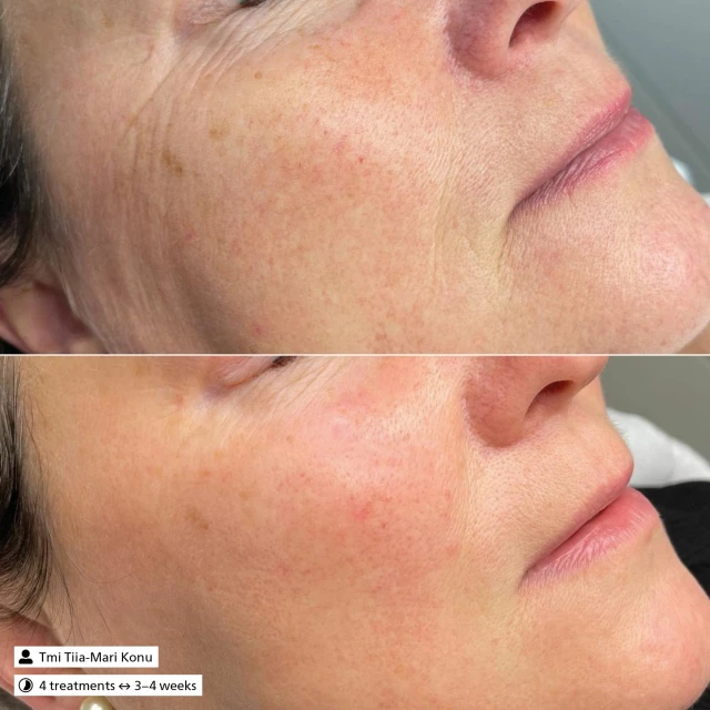 Антиоксидантная осветляющая сыворотка дорожный формат - изображение 3