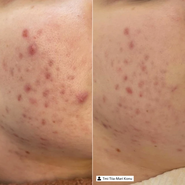 Очищающая маска с серебром дорожный формат - изображение 4