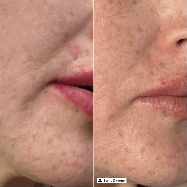 Увлажняющий дневной крем SPF15 дорожный формат - изображение 4