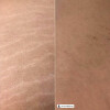 Профессиональная укрепляющая сыворотка