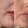 Увлажняющий дневной крем SPF15