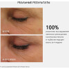 Набор для лифтинга и уплотнения кожи
