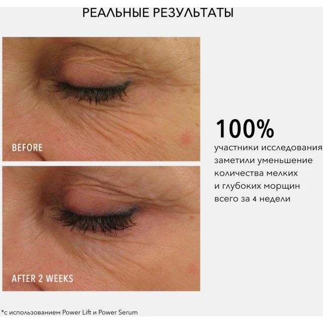 Набор для лифтинга и уплотнения кожи - изображение 3