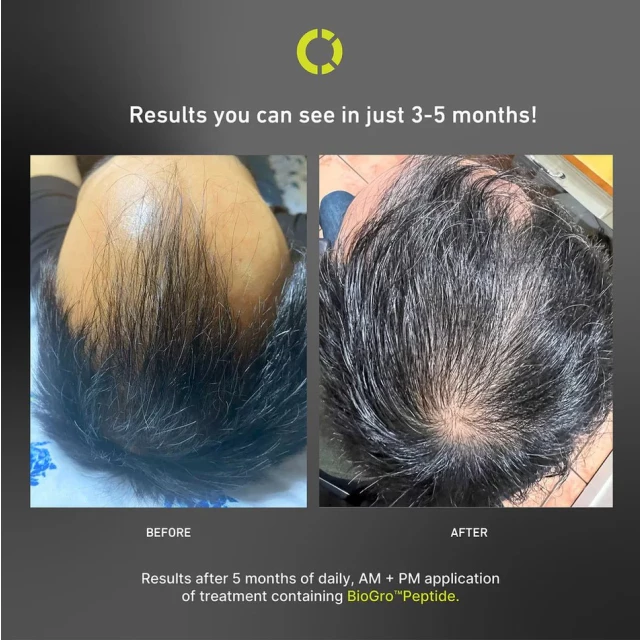 Сыворотка для волос с активатором волосяных фолликулов - изображение 3