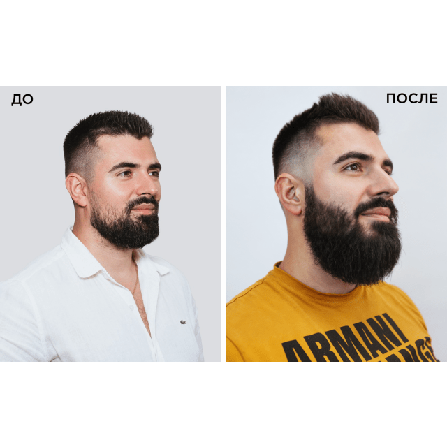 Спрей для роста волос 3в1 Kopexidil - изображение 4