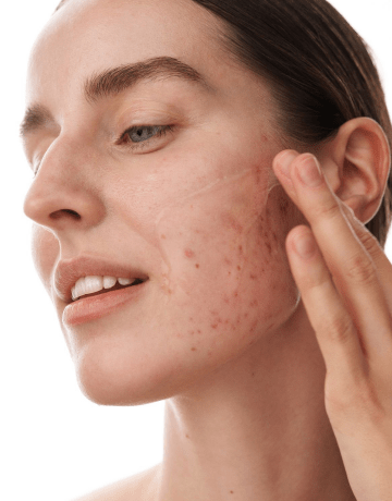 Дерма СР (Derma SR) - изображение 2