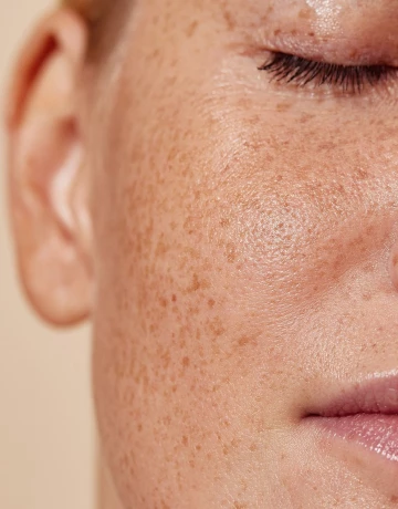 2. Эксфолиация - изображение 2