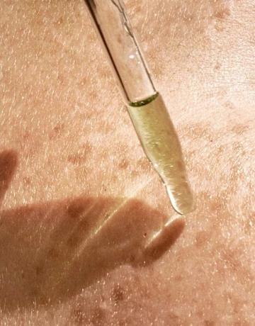 Что такое гиперпигментация? - изображение 1