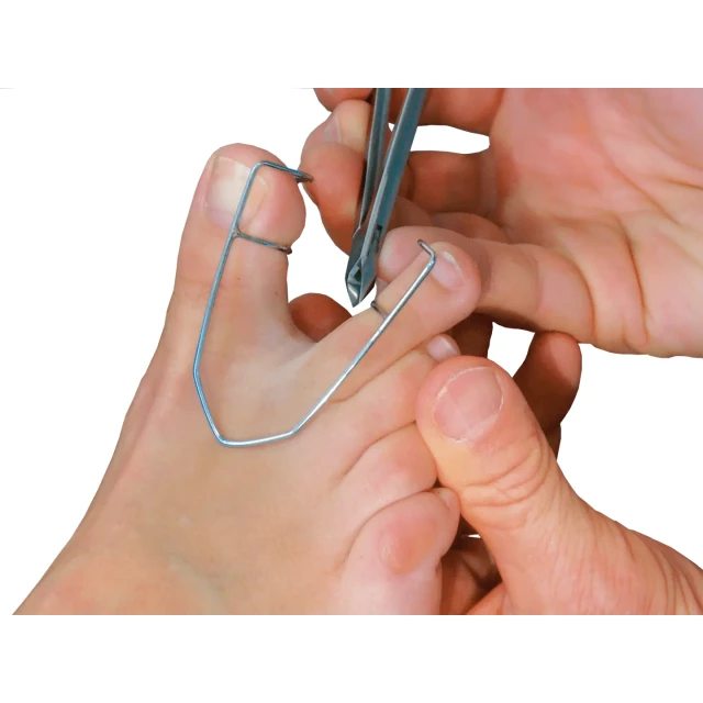 Разделитель для облегчения доступа к межпальцевым промежуткам, большой 2126502 - изображение 2