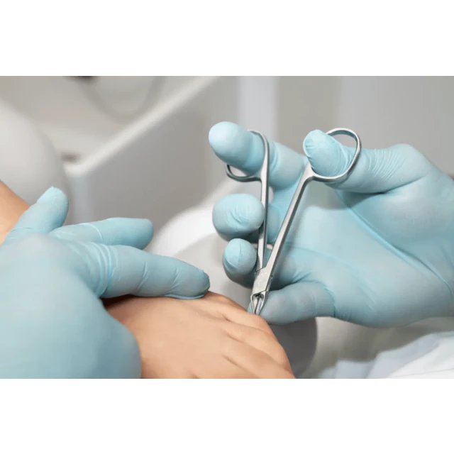 Щипцы для кожи 21172 - изображение 3