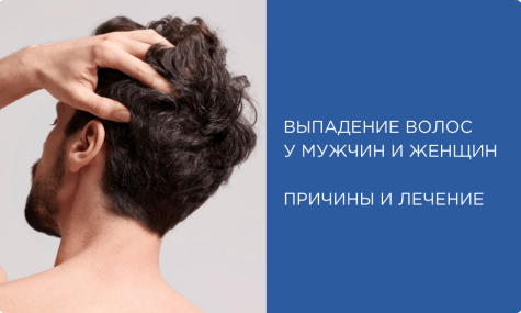 Выпадение волос: причины у мужчин и женщин, лечение, эффективное средство от выпадения