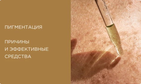 Пигментация на лице: причины и эффективные средства для борьбы с пигментными пятнами в домашних условиях