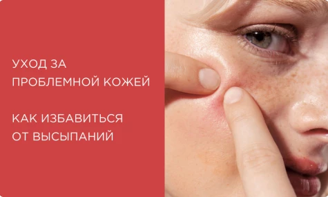 Как избавиться от высыпаний: правильный уход за проблемной кожей