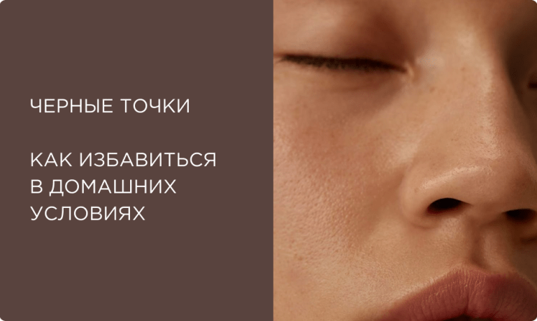 Как избавиться от черных точек на лице: пошаговый домашний уход