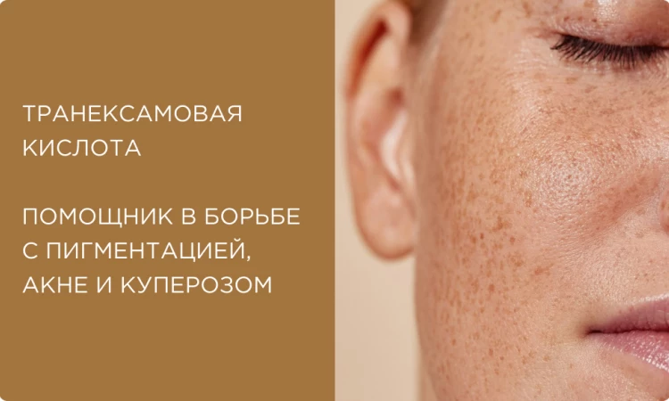 Транексамовая кислота: всесезонная помощь в борьбе с пигментацией, акне и куперозом