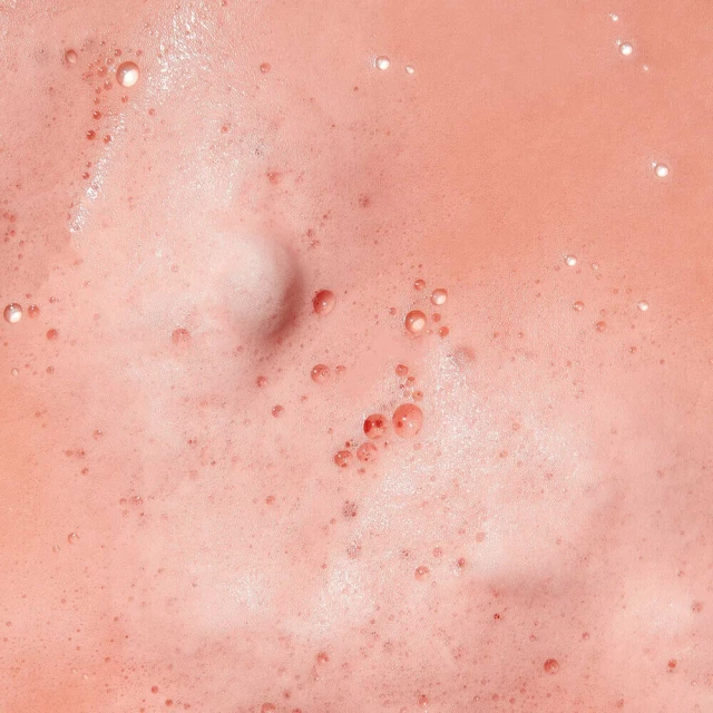 Сыворотка пузырьковая с азелаиновой кислотой - изображение 2