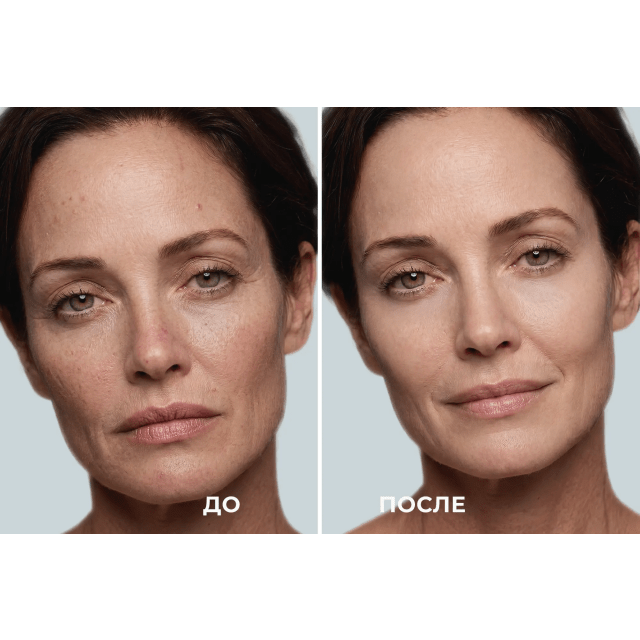 Беспроводная маска для фототерапии 3.0 - изображение 2
